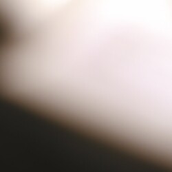 Lo strabismo di Venere